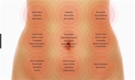 zona abdominala|Dureri abdominale. Cele mai frecvente 20 de cauze ale durerii din。